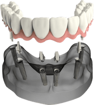fuul-fixed-teeth-img