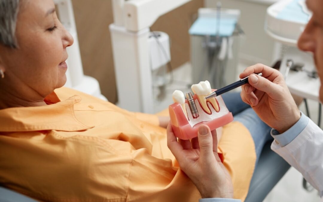 How Long Does It Take to Get Dental Implants? A Step-by-Step Guide for Patients