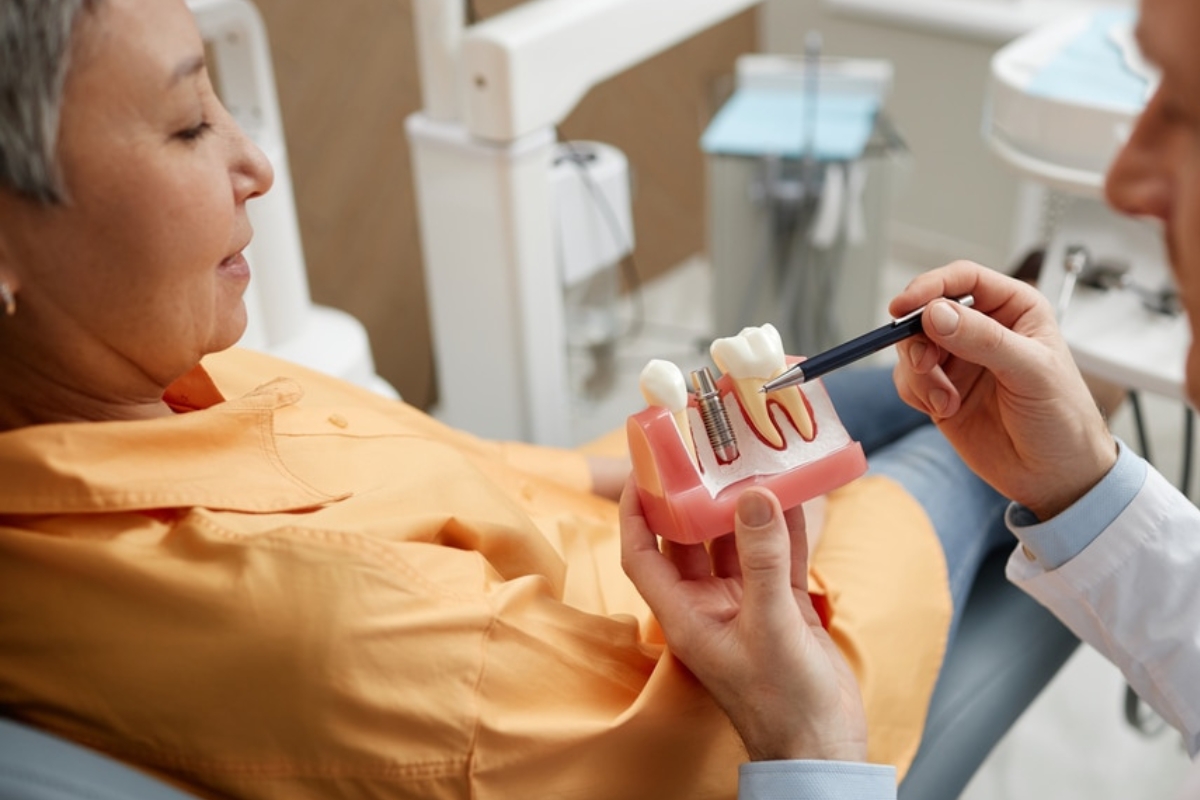 step by step guide for dental implants in roswell step by step guide for dental implants in roswell