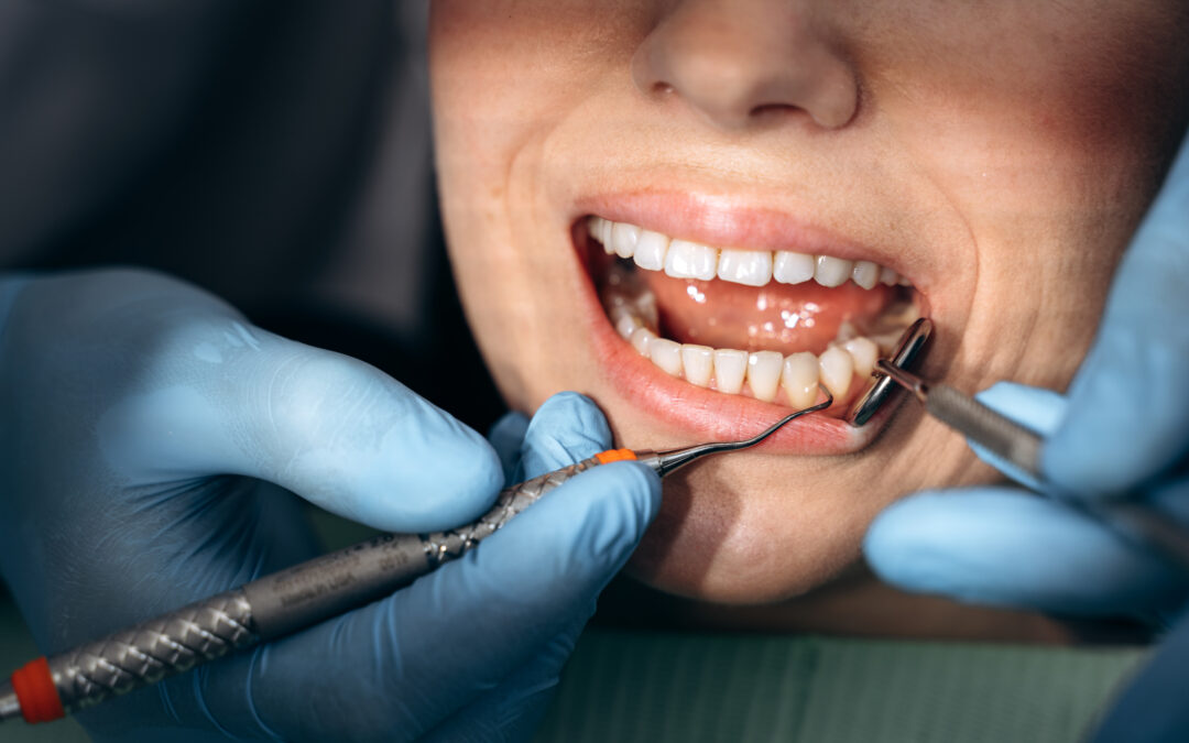 What to Expect During a Professional Dental Cleaning: Step-by-Step Guide