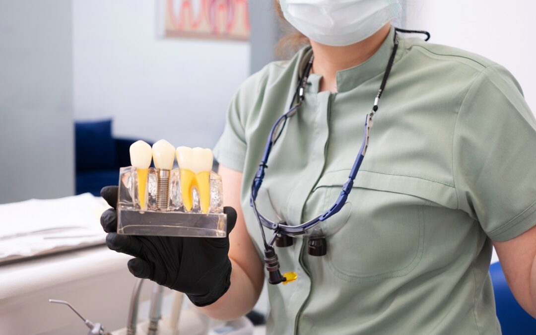 What Should You Ask Before Choosing a Dental Implant Dentist?
