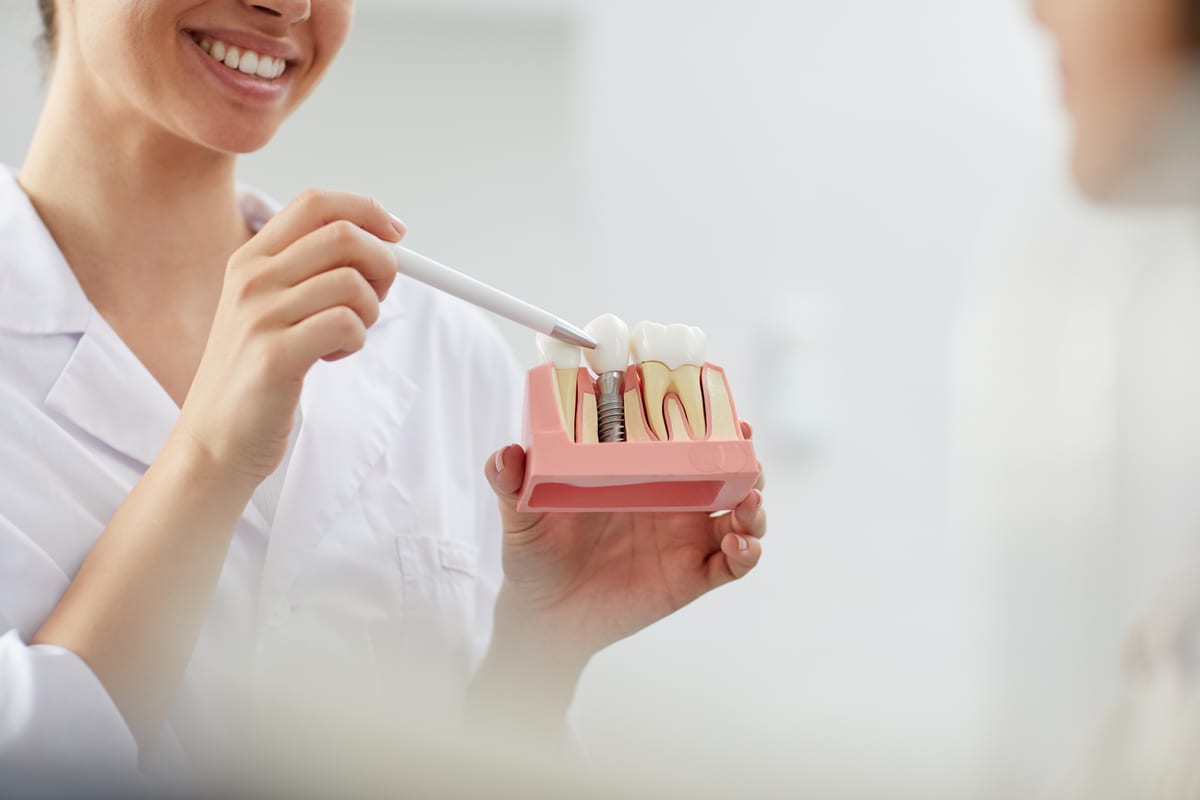 Dental Implants in Roswell Dental Implants in Roswell